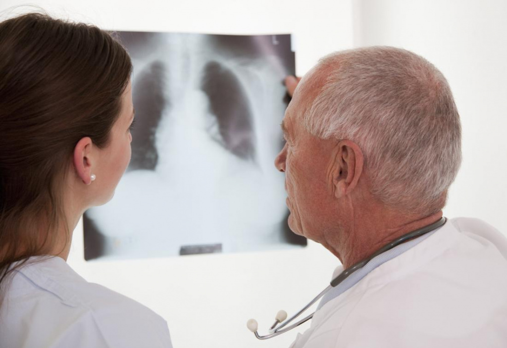 doctor-and-copd-patient-looking-at-x-ray-of-lungs.jpg